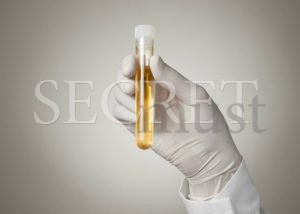 urine-test